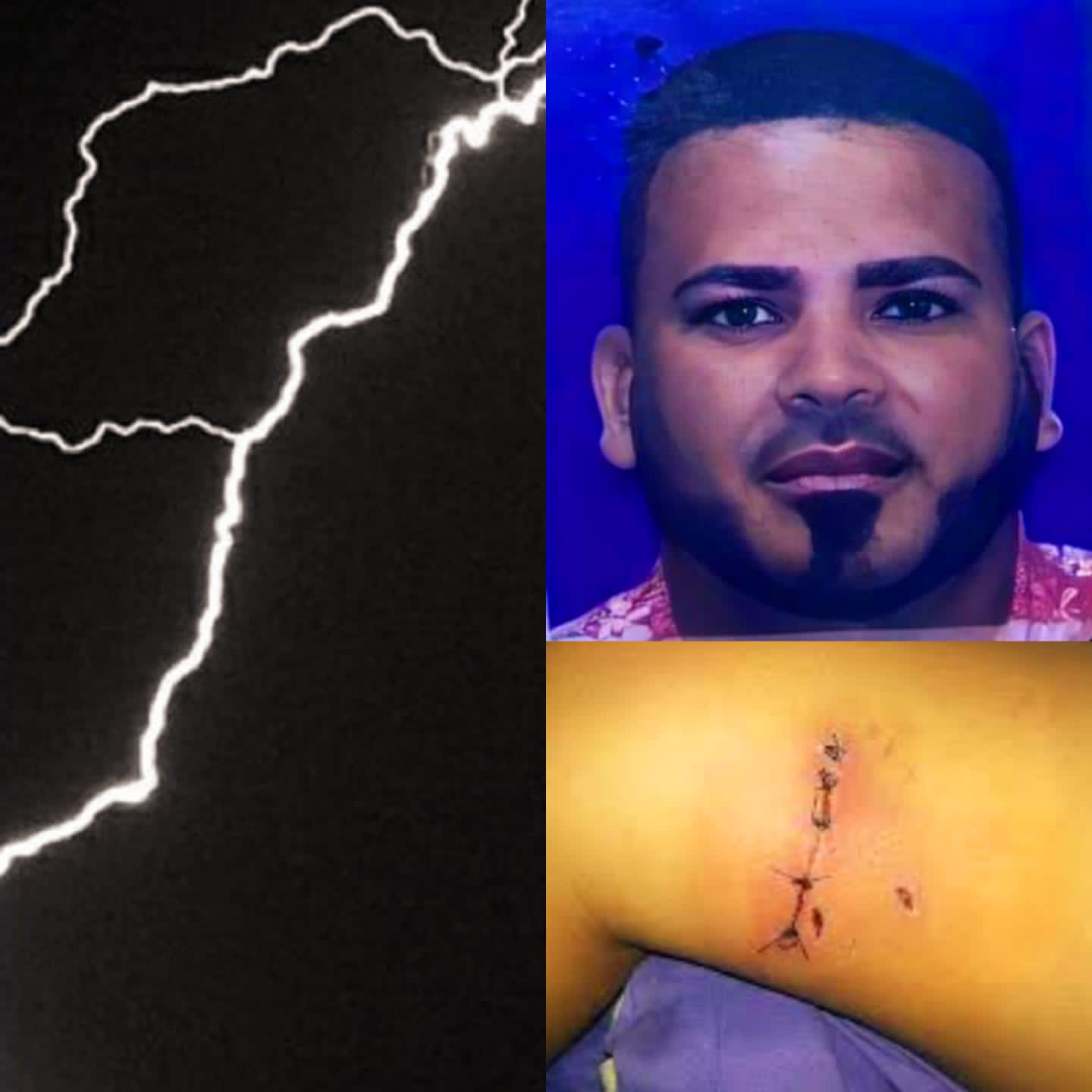 ¡Qué Barbaridad! Muere hombre electrocutado y su mujer es mordida por un perro en Sosúa